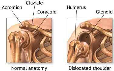 Frozen Shoulder Treatment in Brighton & Hove